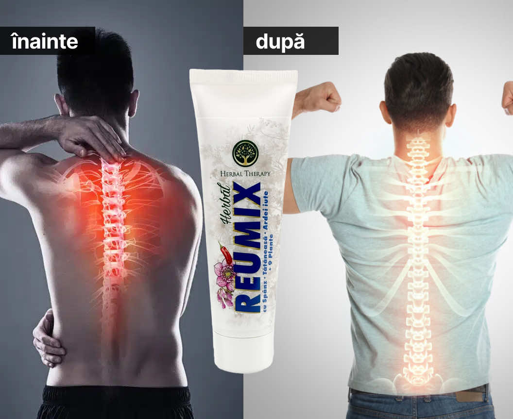 Reumix Emulgel, 100 ml – îngrijire locală pentru mușchi și articulații - imagine 3